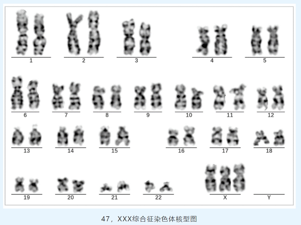 超雌现象，生物学中的独特奥秘探索